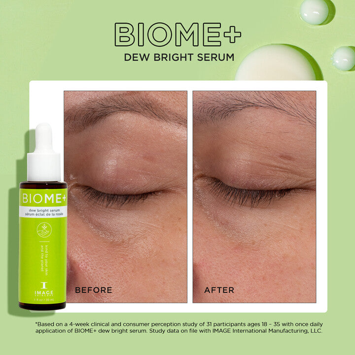 Biome+ Dew Bright Serum ( 30ml )