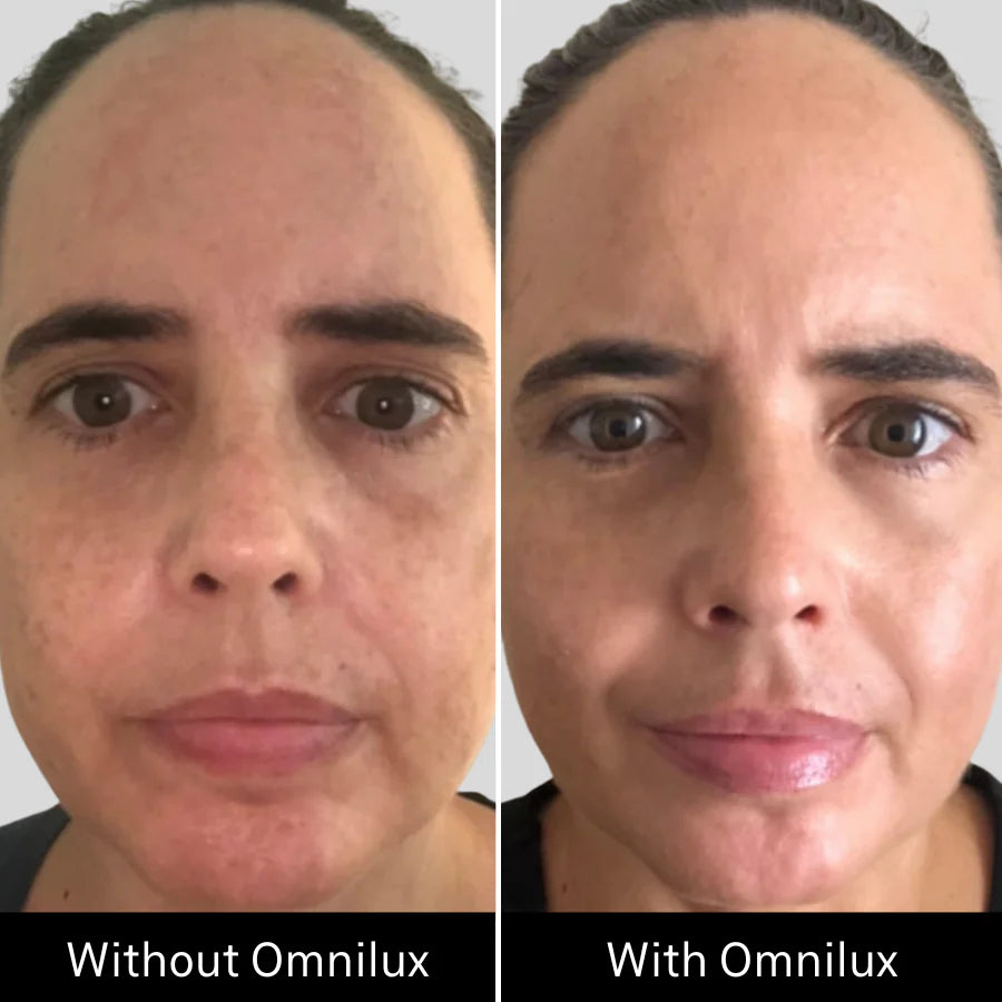 Omnilux Contour Face