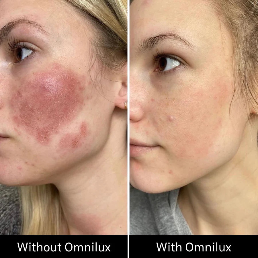 Omnilux Contour Face