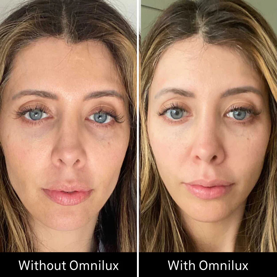 Omnilux Contour Face