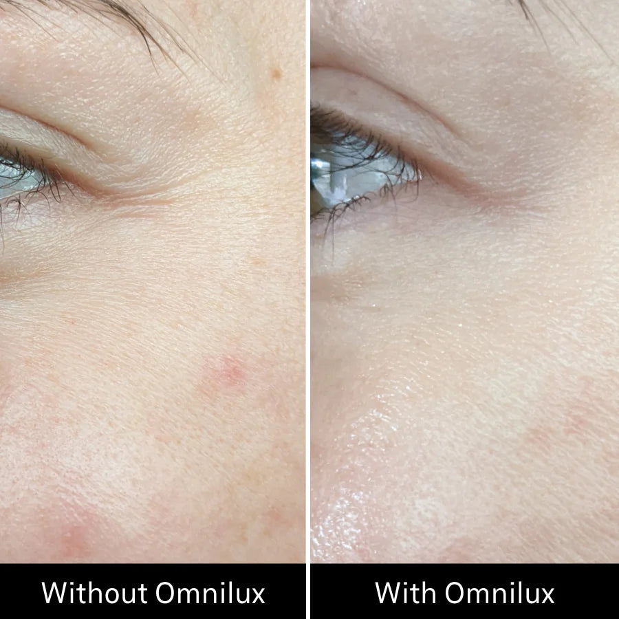 Omnilux Contour Face